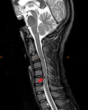 spine x-ray