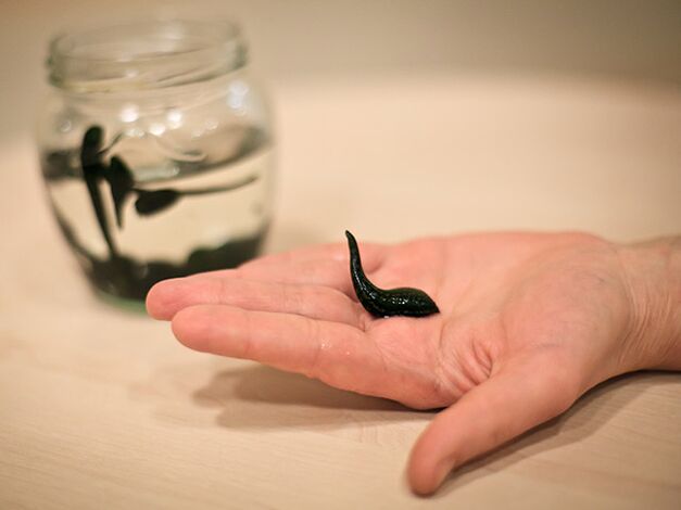 Application for the treatment of osteoarthritis of the knee joint.