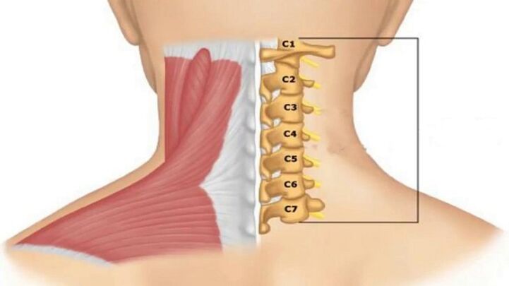 Radicular syndrome manifests itself depending on which vertebra compresses the nerve endings. 